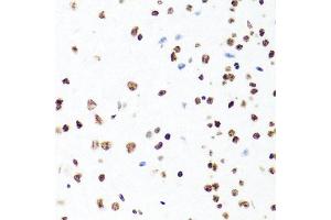 Immunohistochemistry of paraffin-embedded mouse brain using H1F0 antibody (ABIN5971687) at dilution of 1/100 (40x lens). (Histone H1 anticorps)