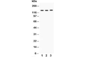 Western blot testing of Integrin alpha 1 antibody and Lane 1:  rat brain (Integrin alpha 1 anticorps  (C-Term))
