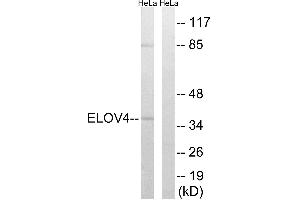 Western blot analysis of extracts from HeLa cells, using ELOVL4 antibody.