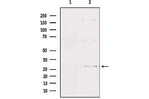 Western blot analysis of extracts from Hepg2, using FMR1NB Antibody.