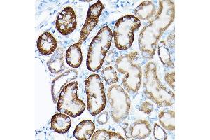 Immunohistochemistry of paraffin-embedded rat kidney using SIRT3 Rabbit pAb (ABIN6134063, ABIN6147792, ABIN6147795 and ABIN6223143) at dilution of 1:50 (40x lens).