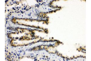 Anti- XBP Picoband antibody, IHC(P) IHC(P): Rat Lung Tissue