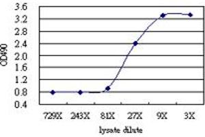 S100A8 (Human) Matched Antibody Pair