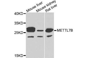 Western blot analysis of extracts of various cells, using METTL7B antibody. (METTL7B anticorps)