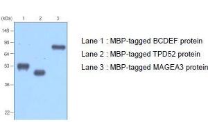 Western Blotting (WB) image for anti-MBP Tag antibody (ABIN317541) (MBP Tag anticorps)