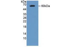 Detection of Recombinant CADM1, Human using Polyclonal Antibody to Cell Adhesion Molecule 1 (CADM1)