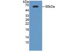 Detection of Recombinant CADM1, Human using Polyclonal Antibody to Cell Adhesion Molecule 1 (CADM1) (CADM1 anticorps  (AA 27-292))