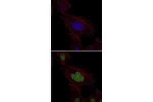 Immunofluorescence analysis of HeLa cells using MSH6 monoclonal antibody, clone 3E1  (green).