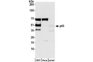 Western Blotting (WB) image for anti-Tumor Protein P53 (TP53) (AA 325-375) antibody (ABIN7450532)