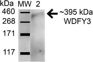 Western blot analysis of Human HeLa and 293Trap cell lysates showing detection of 395. (WDFY3 anticorps  (AA 533-544) (FITC))