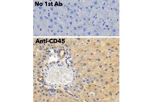 Immunohistochemistry (IHC) image for anti-Protein tyrosine Phosphatase, Receptor Type, C (PTPRC) (C-Term) antibody (ABIN6254211) (CD45 anticorps  (C-Term))