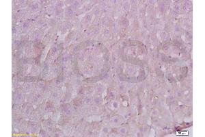 Formalin-fixed and paraffin embedded Rat liver labeled with Anti-FBN1/fibrillin 1 Polyclonal Antibody, Unconjugated (ABIN738501) at 1:200 followed by conjugation to the secondary antibody and DAB staining. (Fibrillin 1 anticorps  (AA 401-500))