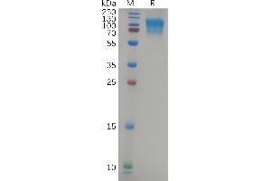 Human CD164 Protein, hFc Tag on SDS-PAGE under reducing condition.