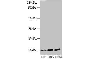 Western blot All lanes: TPRKB antibody at 5 μg/mL Lane 1: A549 whole cell lysate Lane 2: Jurkat whole cell lysate Lane 3: MCF-7 whole cell lysate Secondary Goat polyclonal to rabbit IgG at 1/10000 dilution Predicted band size: 20, 17, 24 kDa Observed band size: 20 kDa (TPRKB anticorps  (AA 1-175))