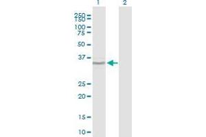 Western Blot analysis of BCOR expression in transfected 293T cell line by BCOR polyclonal antibody (A01).