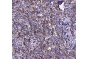 ABIN6268692 at 1/100 staining human Lymph node tissues sections by IHC-P. (IL-8 anticorps  (Internal Region))
