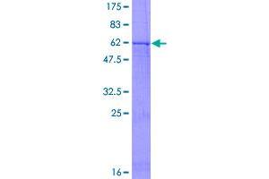 Image no. 1 for Serotonin Receptor 1D (HTR1D) (AA 1-377) protein (GST tag) (ABIN1307261)