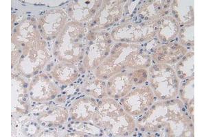 Figure. (JAK1 anticorps  (AA 596-841))