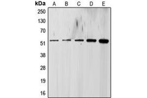 Western blot analysis of ALK5 expression in HeLa (A), LO2 (B), Raw264.