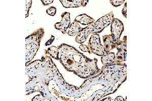 IHC analysis of SNRNP40 using anti-SNRNP40 antibody (ABIN7601719). (SNRNP40 anticorps  (AA 43-357))