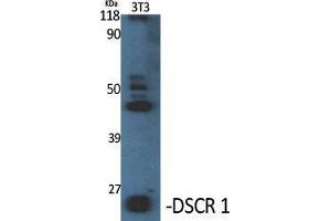 Western Blot (WB) analysis of specific cells using DSCR 1 Polyclonal Antibody.