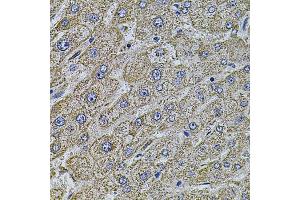Immunohistochemistry of paraffin-embedded human liver injury using MAP1B antibody (ABIN5971696) at dilution of 1/100 (40x lens). (MAP1B anticorps)