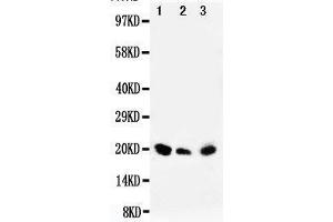 Anti-DUSP3 antibody, Western blotting Lane 1: Rat Testis Tissue Lysate Lane 2: SKOV Cell Lysate Lane 3: MM453 Cell Lysate