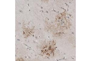 Immunohistochemical staining of human hippocampus with PLEKHF1 polyclonal antibody  shows strong cytoplasmic positivity in astrocyte-like cells. (PLEKHF1 anticorps)