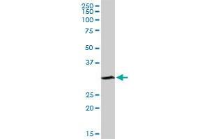 SULT1A1 MaxPab rabbit polyclonal antibody.