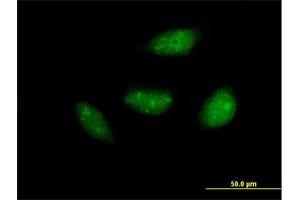 Immunofluorescence of purified MaxPab antibody to NOL6 on HeLa cell.