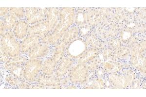 Detection of C8g in Human Kidney Tissue using Polyclonal Antibody to Complement Component 8g (C8g) (C8G anticorps  (AA 39-202))