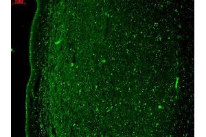 Immunohistochemistry analysis using Mouse Anti-KCNQ4 Monoclonal Antibody, Clone N43/6 (ABIN361768).