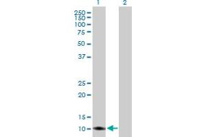 Western Blot analysis of TIMM8A expression in transfected 293T cell line by TIMM8A MaxPab polyclonal antibody. (TIMM8A/DDP anticorps  (AA 1-97))