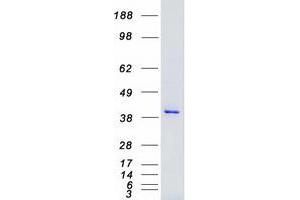 Validation with Western Blot