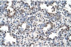 Immunohistochemical staining (Formalin-fixed paraffin-embedded sections) of human lung with FAM134B polyclonal antibody  at 4-8 ug/mL working concentration. (FAM134B anticorps  (Internal Region))