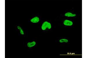 Immunofluorescence of monoclonal antibody to TCEA3 on HepG2 cell.