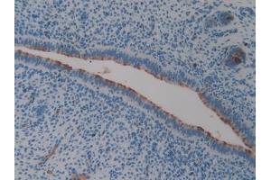 Detection of CLU in Mouse Uterus Tissue using Polyclonal Antibody to Clusterin (CLU)