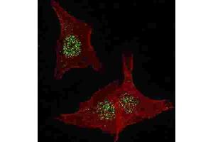 Immunofluorescence (IF) image for anti-Fibroblast Growth Factor Receptor 4 (FGFR4) antibody (ABIN3003375)