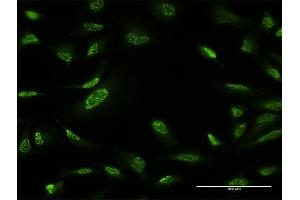 Immunofluorescence of monoclonal antibody to ZBTB25 on HeLa cell. (ZBTB25 anticorps  (AA 331-435))