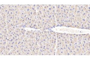 Detection of CHI3L1 in Mouse Liver Tissue using Polyclonal Antibody to Chitinase-3-like Protein 1 (CHI3L1) (CHI3L1 anticorps  (AA 112-356))