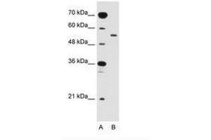 Image no. 1 for anti-Solute Carrier Family 2 (Facilitated Glucose Transporter), Member 10 (SLC2A10) (AA 371-420) antibody (ABIN205022) (SLC2A10 anticorps  (AA 371-420))