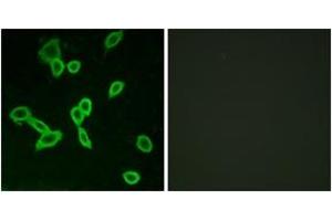 Immunofluorescence analysis of LOVO cells, using LGR6 Antibody. (LGR6 anticorps  (AA 471-520))
