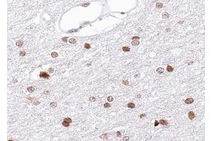 ABIN6269234 at 1/100 staining human brain tissue sections by IHC-P. (BRCA1 anticorps  (Internal Region))
