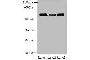 Western blot All lanes: Smox antibody at 3 μg/mL Lane 1: PC-3 whole cell lysate Lane 2: A549 whole cell lysate Lane 3: 293T whole cell lysate Secondary Goat polyclonal to rabbit IgG at 1/10000 dilution Predicted band size: 62, 66, 27, 23, 28, 60, 57, 47, 61, 21 kDa Observed band size: 62 kDa