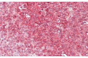 Detection of CAPN1 in Human Tonsil Tissue using Polyclonal Antibody to Calpain 1 (CAPN1)