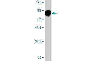 Western Blot detection against Immunogen (74. (Fatty Acid Synthase anticorps  (AA 1-439))