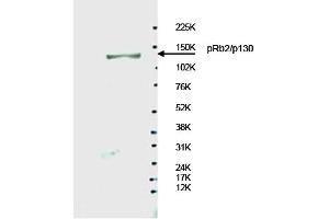 Image no. 1 for anti-Retinoblastoma-Like 2 (p130) (RBL2) antibody (ABIN401457) (p130 anticorps)