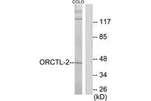 Western blot analysis of extracts from COLO205 cells, using ORCTL-2 Antibody. (ORCTL-2/SLC22A18 anticorps  (AA 359-408))