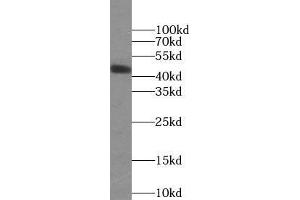 Western blot analysis of human plasma tissue subjected to SDS-PAGE, using ORM2 antibody (1/1000 dilution). (Orosomucoid 2 anticorps)