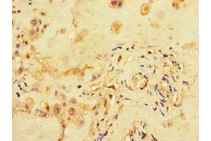 Immunohistochemistry of paraffin-embedded human placenta tissue using ABIN7159100 at dilution of 1:100 (MED1 anticorps  (AA 878-1031))